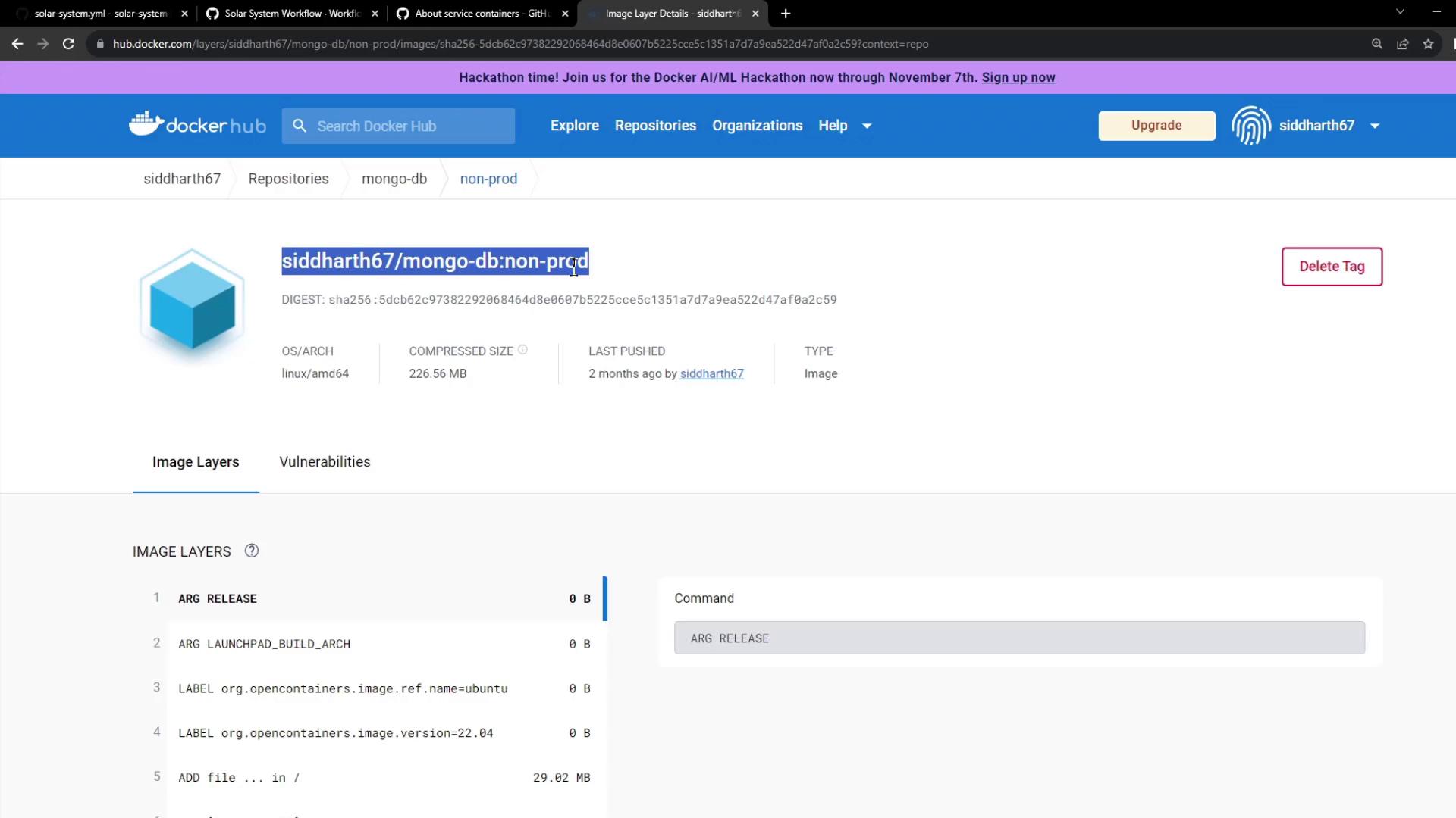The image shows a Docker Hub page displaying details of a Docker image named "siddharth67/mongo-db:non-prod," including its digest, OS/architecture, compressed size, and image layers.